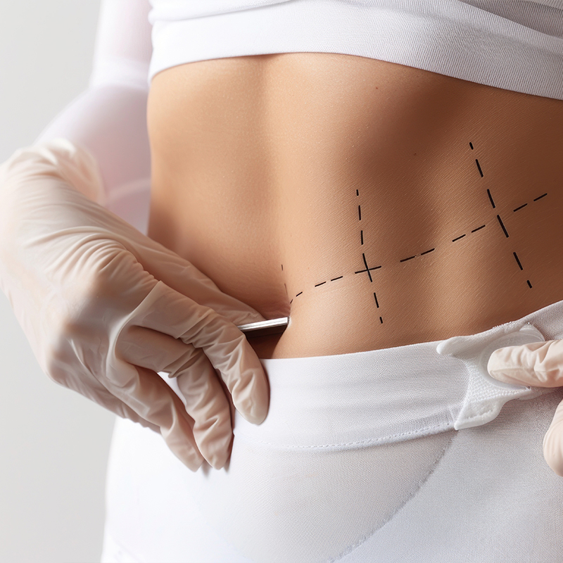 Est-ce que l'abdominoplastie  est douloureuse?